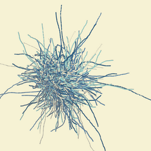 fibinous infection project preview
